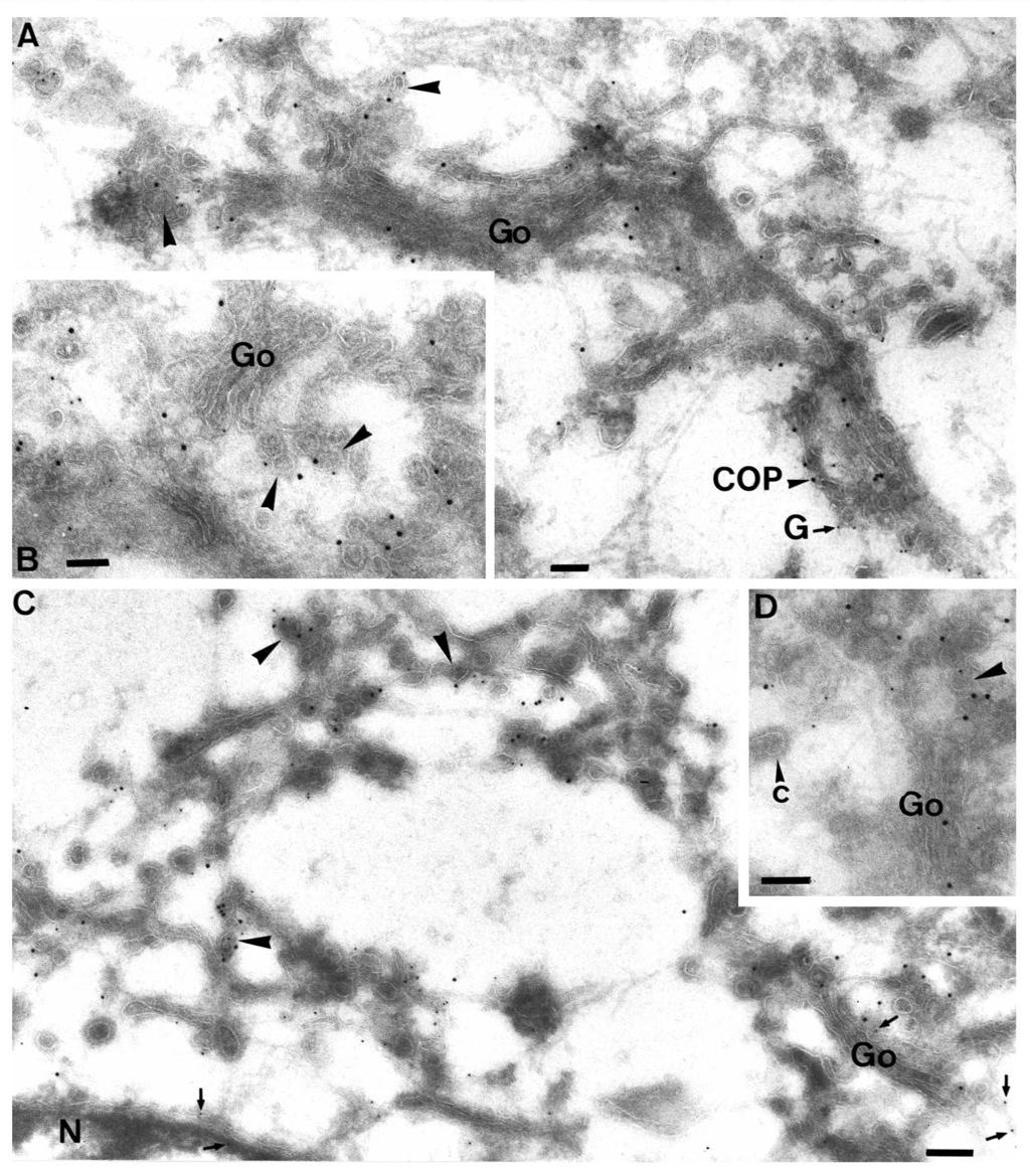 Immunocytochemical localization of β-cop 2847 Fig. 6. Double labelling of L cells infected at 39.5 C and shifted for 3 minutes to 31 C before SLO permeabilization in the presence of GTPγS.