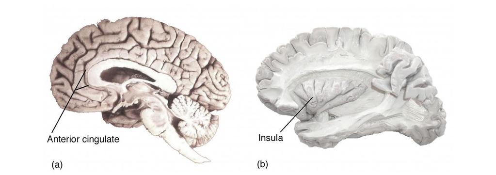 The Neural Basis of Consciousness Figure 15.