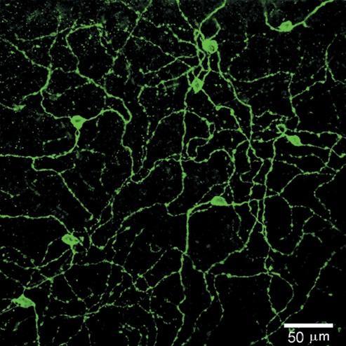 Sleep and Dreaming Figure 15.4: Retinal Ganglion Cells Containing Melanopsin.