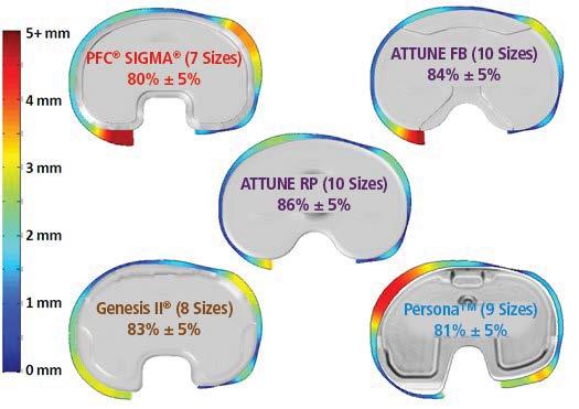 IMPLANT FIT: The ATTUNE Knee System provides an extensive range of sizes to help address challenges associated with implant fit.