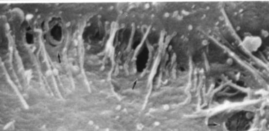 Gap formation Vessel Lumen LPS Hypoxia Platelets Thrombin TNF Reactive Oxygen/Nitrogen Species Stretch