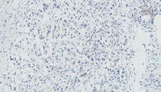 PD-L1 Expression Was Determined by a Validated Dako 28-8 PD-L1 IHC pharmdx 1,2 8 PD-L1 Staining No PD-L1
