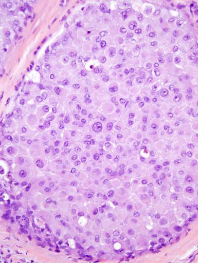 lymphocyte nuclei