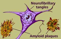 tangles Cell