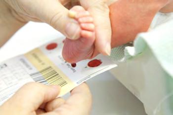 How is MSUD diagnosed? As part of newborn screening, a few drops of blood are collected.