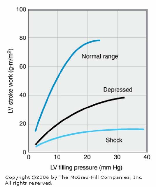 Relation of left ventricular (LV) performance to filling pressure in patients with acute myocardial infarction, an important cause of heart failure.