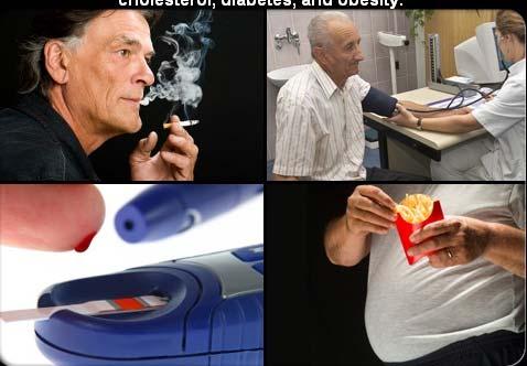 CONGESTIVE CARDIAC FAILURE RISK FACTORS Smoking High BP High Cholestrol Obesity Some of the risk