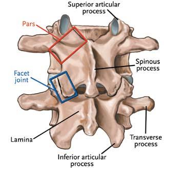 LUMBAR LAMINECTOMY AND DISCECTOMY Basic Anatomical Landmarks: Lumbar Spine Disc Excision When the cushioning disc between the vertebrae protrudes out of the intervertebral space ( slipped disc,