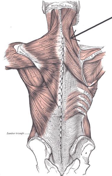 Splenius Capitis and Cervicis These muscles originate on SPs or the Nuchal Ligament and insert on TPs (cervicis) or the occipital