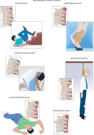 Common Mechanisms of Spine