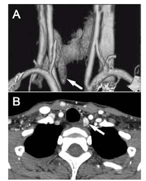 4-Dimensional CT Imaging Perrier JACS 2012, Rodgers Surgery 2006, Mortenson JACS