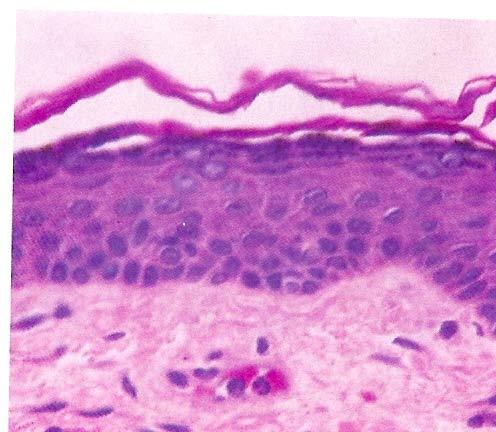 Eyelid Histology Skin layers Epidermis Stratum corneum Stratum lucidum Stratum granulosum Stratum spinosum Stratum