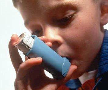 Asthma A chronic inflammatory disease of the airways characterized by reversible bronchospasm.