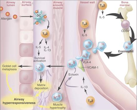 Eosinophils and Asthma From: Wills-Karp and Karp, Science