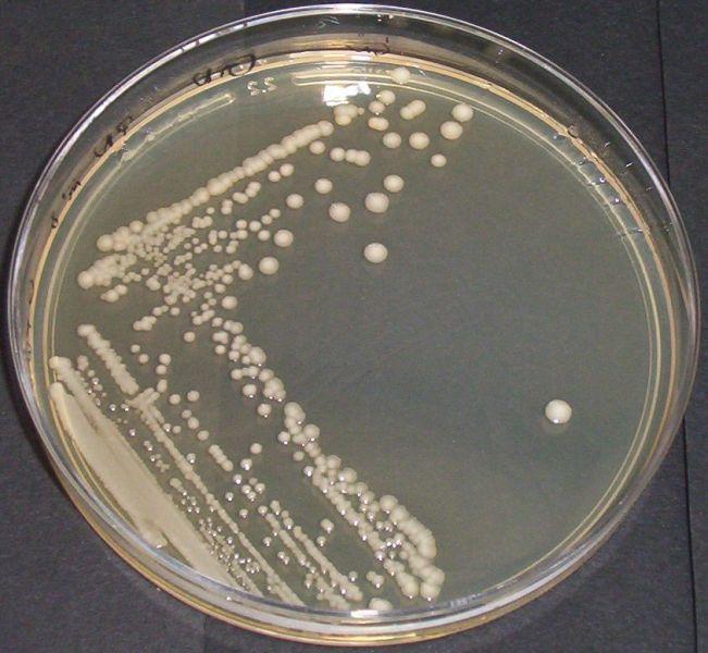 Gram negative bacteria K. pneumonia E.