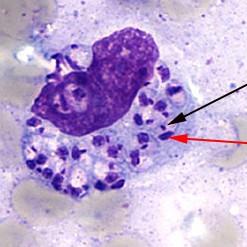 Light-microscopic examination of a stained bone marrow specimen from a patient with visceral leishmaniasis showing a macrophage (a special type of white blood cell) containing multiple