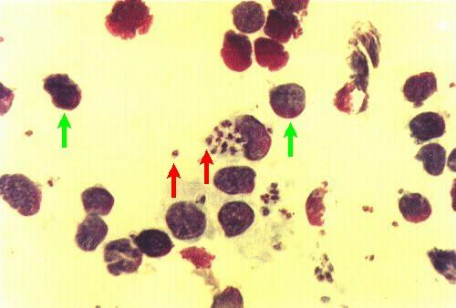 Aflagellate (Amastigote): _ Intracellular form. _ Found in Host.