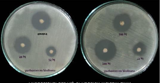 Plate.1 Antibacterial Activity and Antifungal activity of Ethanolic and Aqueous Extracts of A. indicum against Pathogens Antibacterial activity of ethanolic extracts of A.