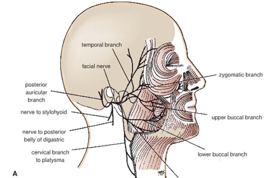 Facial Nerve (VII):