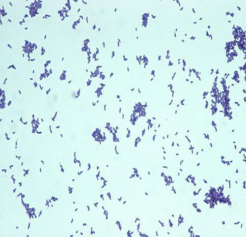 Pharyngitis (cont d) Arcanobacterium haemolyticum Formerly known as Corynebacterium haemolyticum (small GPB), cat -, b hem.