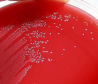 Arcanobacterium haemolyticum is a pleomorphic, facultative, anaerobic gram positive rods It is difficult to recognize on