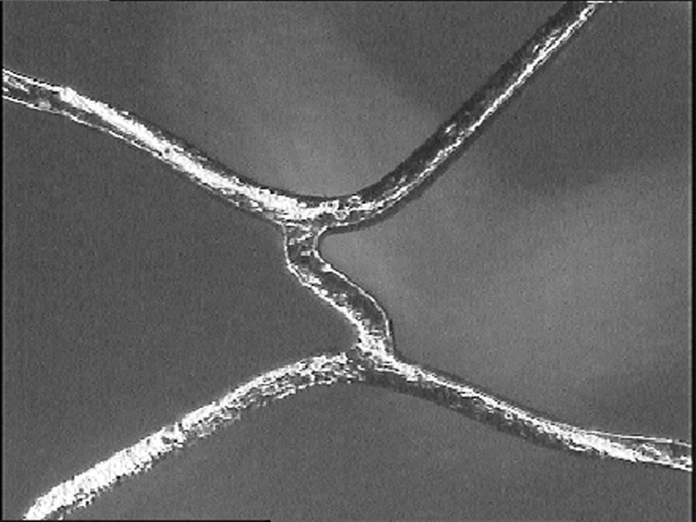 February 1999 49 Figure 7. Detail of an expanded coronary stent. Figure 6. Test chamber used in the measurement of radial stiffness.