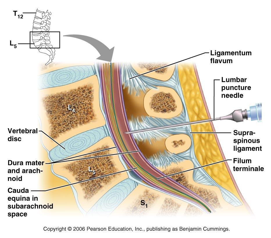 Lumbar Tap Spinal Cord general features Spinal cord has a narrow, fluid filled central canal Central canal is surrounded by butterfly or H-shaped gray matter containing sensory and