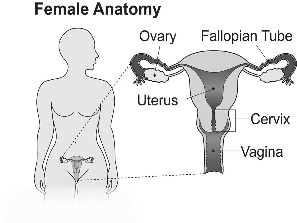 Vaginal cancer: Know what to expect For women with vaginal cancer What is the vagina? The vagina is a hollow canal that connects the cervix and the uterus to the outside. of the body.