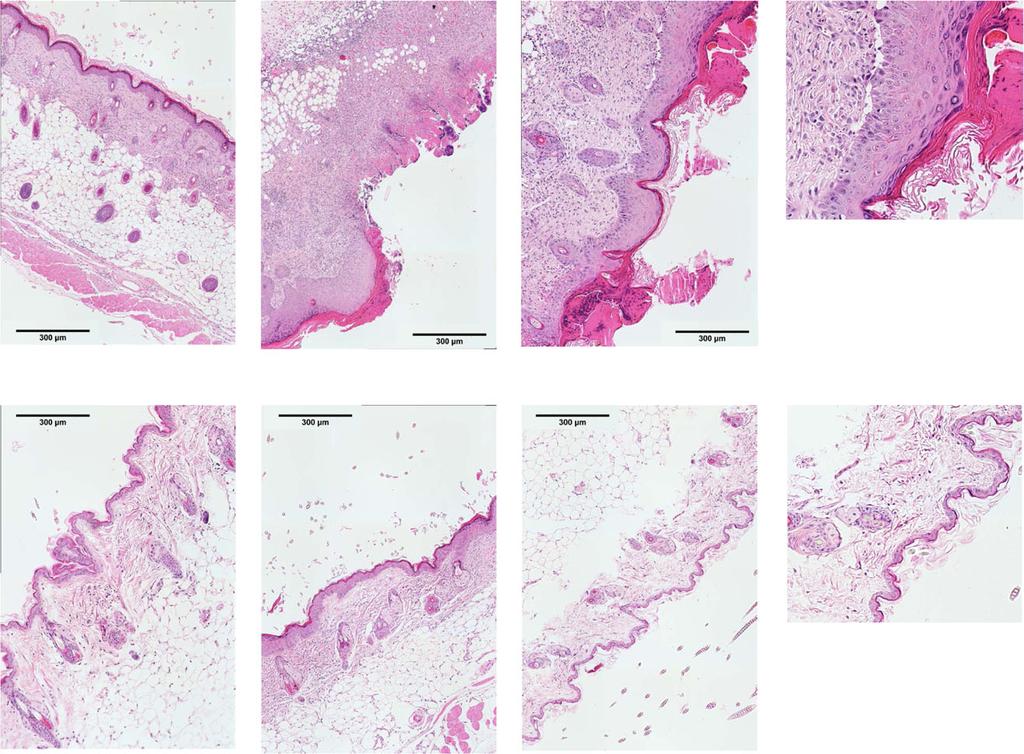 Chlmers et l. Arthritis Reserch & Therpy (2018) 20:10 Pge 5 of 11 c Fig. 2 Skin histology.
