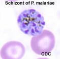 Plasmodium malariae P. malariae usually does not cause life-threatening infections. P. malariae causes low grade parasitemia Description of parasite persistence > 40 years exists.