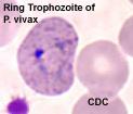 Plasmodium vivax P. vivax usually does not cause life-threatening infections. P. vivax only infects reticulocytes, gives low parasitemia P.
