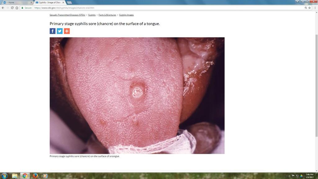 Patient with new genital ulcer or suspicious genital lesion SEXUAL HISTORY, RISK ASSESSMENT &