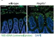 RegIII, an antimicrobial protein binding peptidoglycan.
