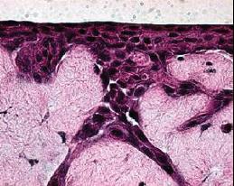 bronchial epithelial cells for early