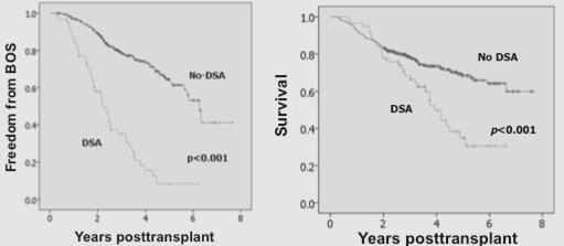 De novo DSA are associated with early and high grade BOS and death after LTx Morrell et al JHLT 2014 445 LTx Follow-up 3.3+1.9y 14.
