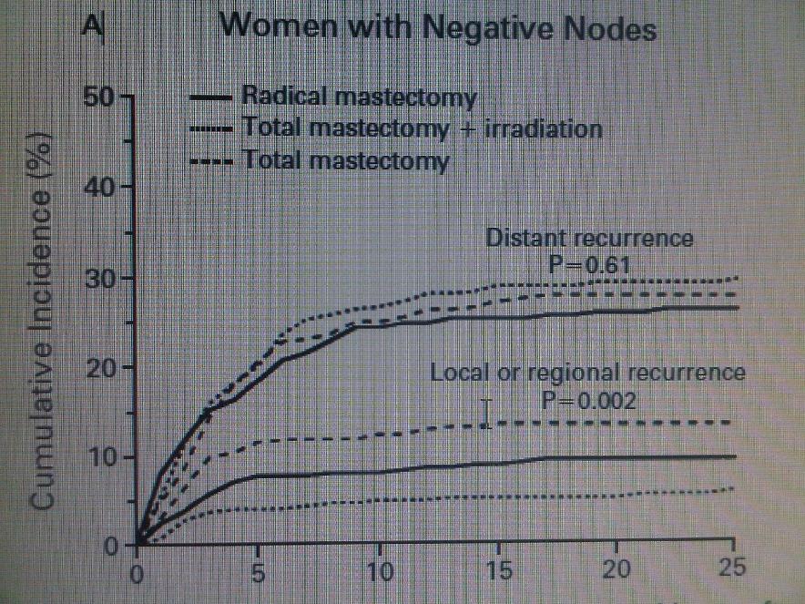 NSABP-B04 trial 1079 clinically node-negative patients Randomised into 3 arms: Halsted mastectomy Simple mastectomy+rt Simple mastectomy 40% of