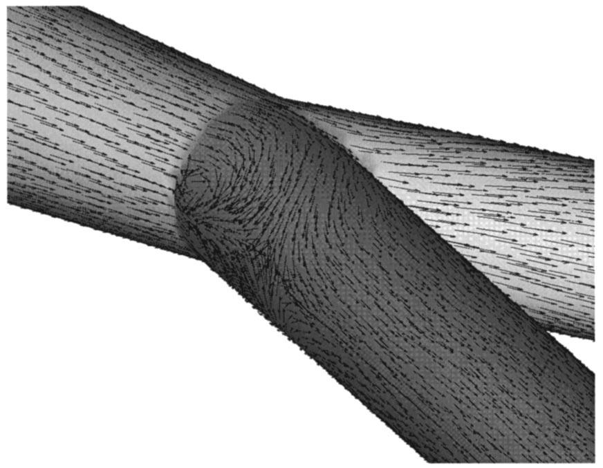 Finite Element Modeling of Flow in the Abdominal Aorta 981 FIGURE 7. Mean surface traction vectors at the aortic bifurcation.