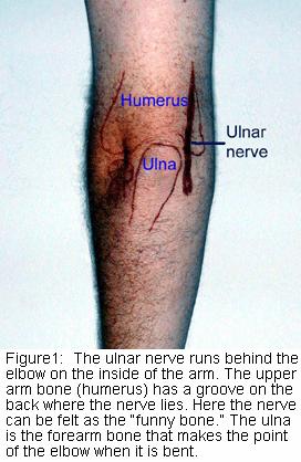 Ulna neuritis Due to entrapment of the ulna nerve at the elbow Produces paraesthesia of ring and little finger