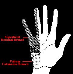 Cubital Tunnel Syndrome Ring and pinky fingers as well as ulnar margin of forearm Nerve may subluxate creating a popping sensation May complain of loss of strength