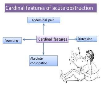 bowel obstruction Late in small bowel obstruction Absolute