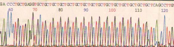 What is a microsatellite? A short, simple DNA nucleotide sequence (CA, CGA, GCG, GCC, GAAA...) Which is repeated in tandem in a head-to-tail fashion (CACACACACA.