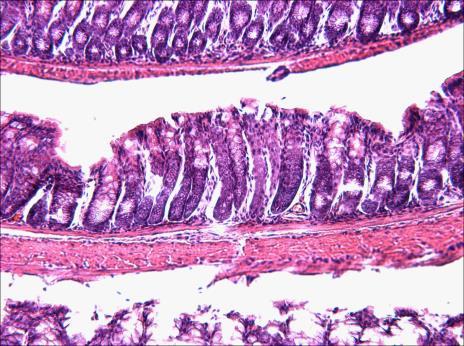 (C) Hematoxylin-eosin staining of small and large intestines. Scale bar = 1 μm.