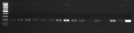 () Representative gel images of PCR analysis using -specific primer (F : 5 -CTGCCTCATACTCGGGGATA-3, R : 5 - CGTAGGAGTTTGGACCGTGT- 3 ; product size : 216 bp).