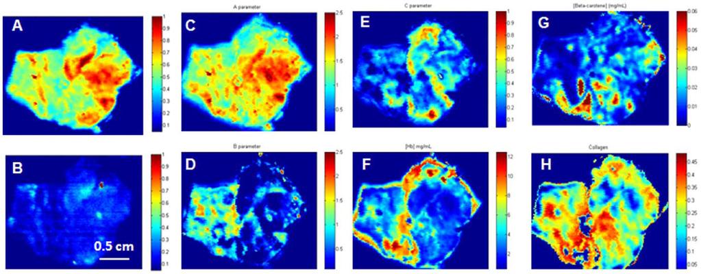 Spectral Intensity and Parameter Maps of Breast Tissue.