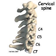 There are now several Cervical artificial disc replacement devices that have been approved by the FDA for use in the United States. The artificial disc is inserted in the space between two vertebrae.