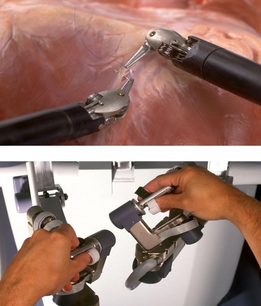 The Surgeon Directs The Instruments The surgeon s hands operate the masters and his feet control the pedals allowing total control of the robot