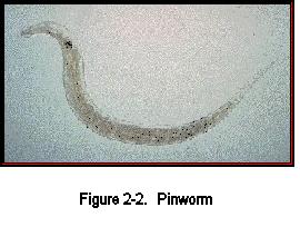 c. Enterobius vermicularis. Enterobius vermicularis (pronounced EN-tur-Obee-us ver-mick-yoo-lair-is) is frequently referred to as the pinworm (figure 2-2).