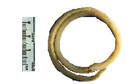 d. Ascaris lumbricoides. Ascaris lumbricoides (pronounced AS-kar-is lum-bri- KOY-deez) is usually referred to as the large intestinal roundworm (figure 2-3).