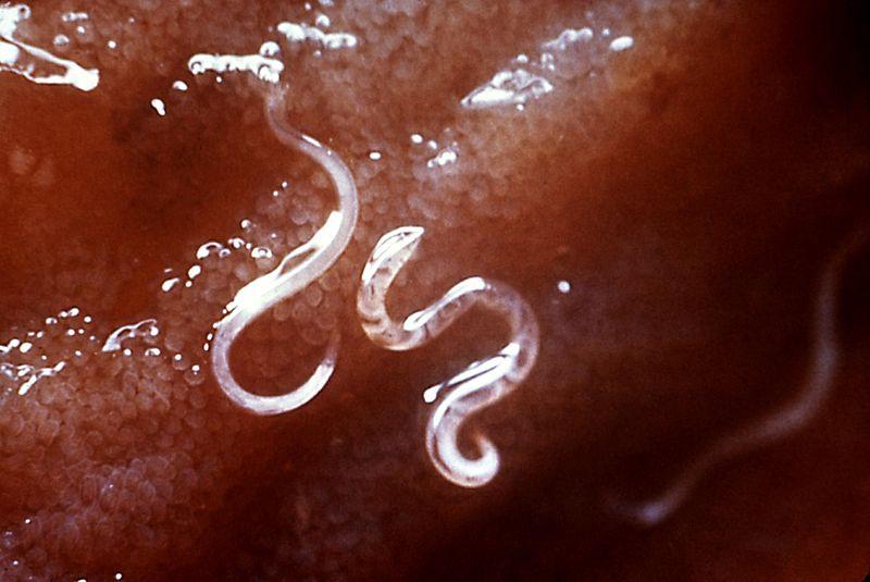 Hookworm Diagnosis Exams and Tests CBC Stool