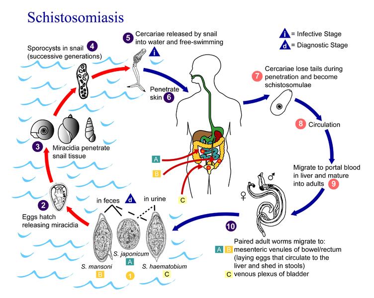 Schistosomiasis Acute schistosomiasis (Katayama's fever) may